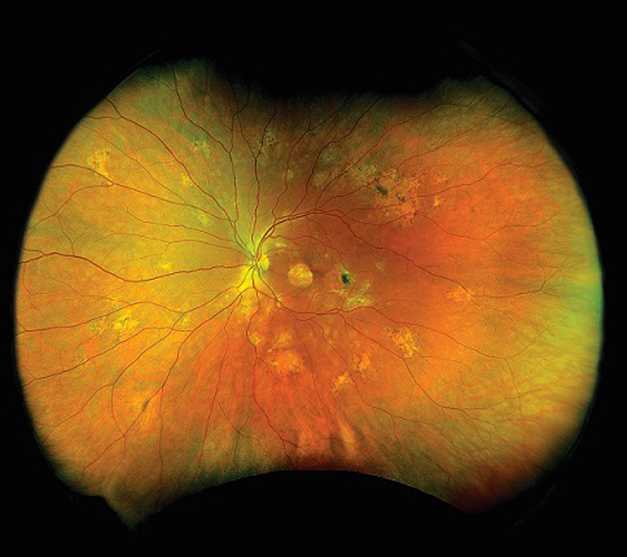 optomap Farbe